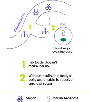 Representation of how type 1 diabetes work in the bloodstream
